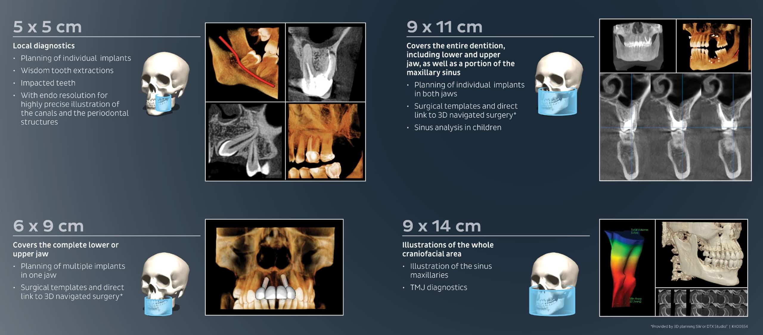 cone-beam-ct-procedure-code-the-best-picture-of-beam