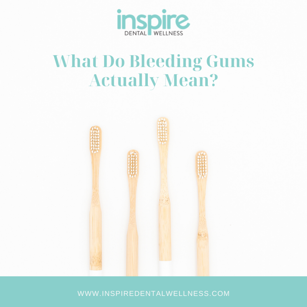 Bleeding Gums Blog Graphic
