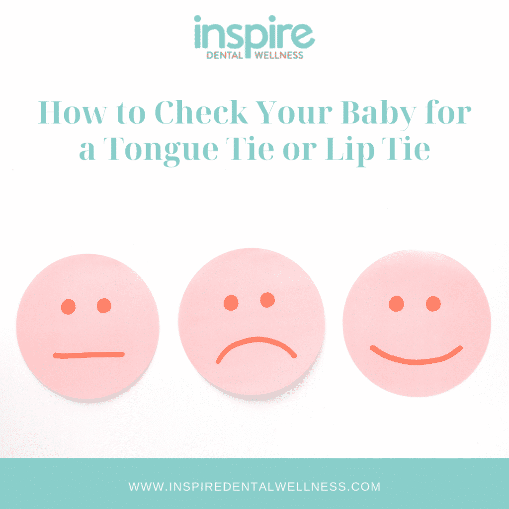How to Check Your Baby for a Tongue Tie or Lip Tie