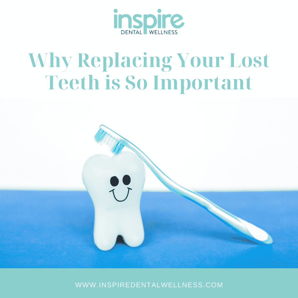Why Replacing Your Lost Teeth is So Important